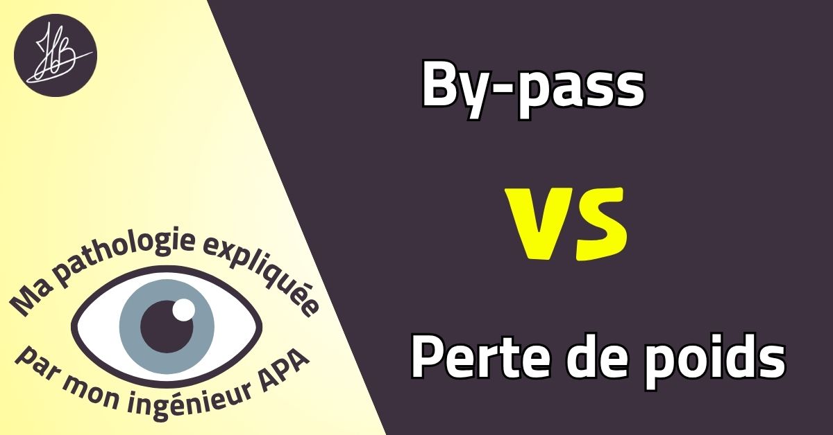 By-pass VS Perte de poids – Ma pathologie expliquée