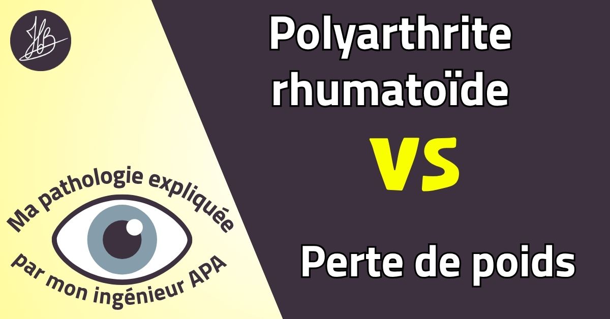 Polyarthrite rhumatoïde VS Perte de poids – Ma pathologie expliquée