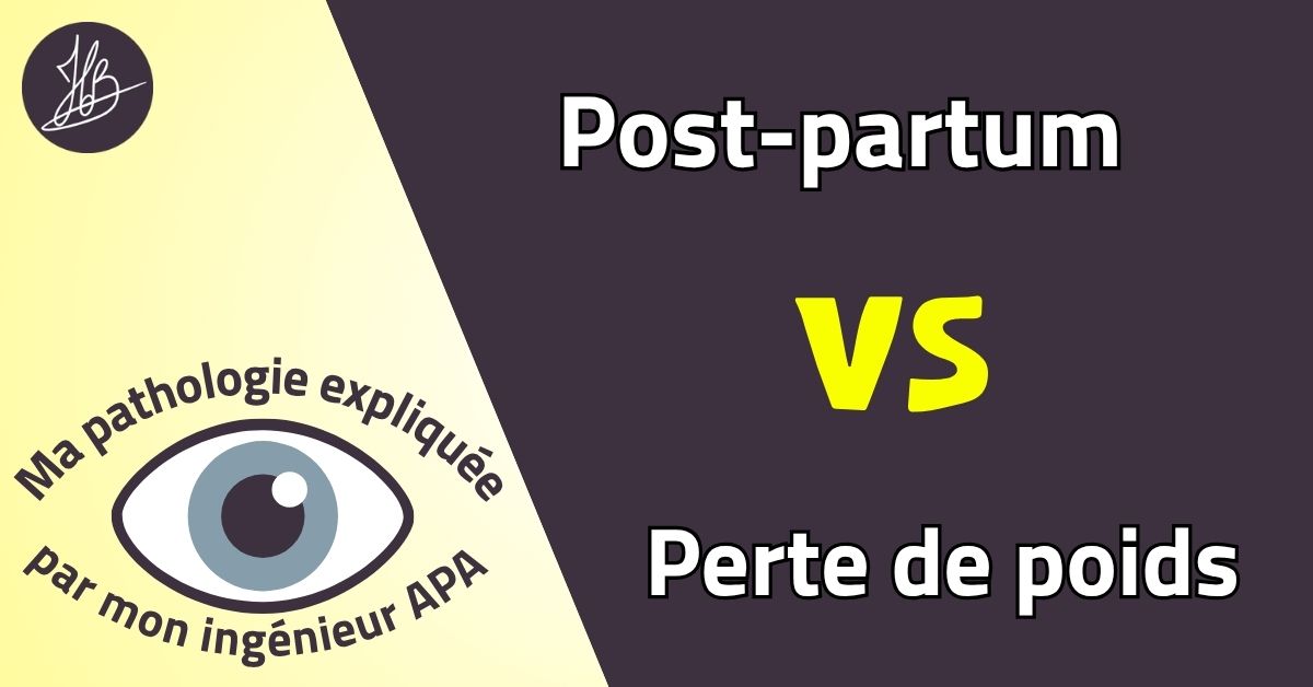 Post-partum VS Perte de poids – Ma pathologie expliquée