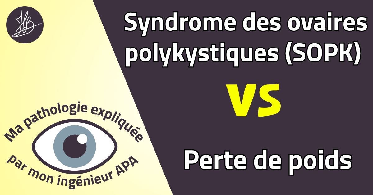 Syndrome des ovaires polykystiques (SOPK) VS Perte de poids – Ma pathologie expliquée