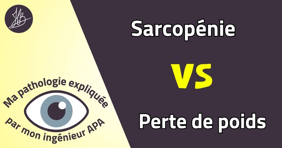 Sarcopénie VS Perte de poids – Ma pathologie expliquée