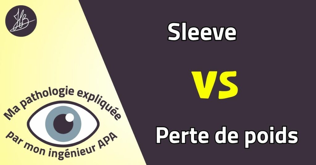 Illustration : Sleeve vs perte de poids. Ma pathologie expliquée par mon ingénieur APA
