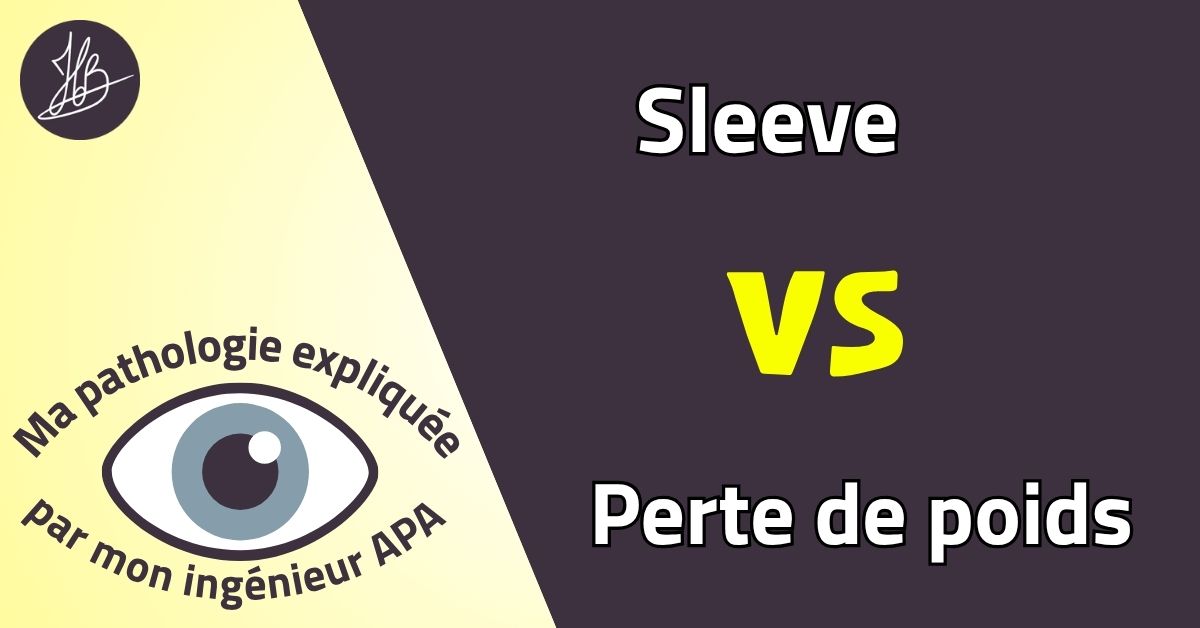 Sleeve VS Perte de poids – Ma pathologie expliquée
