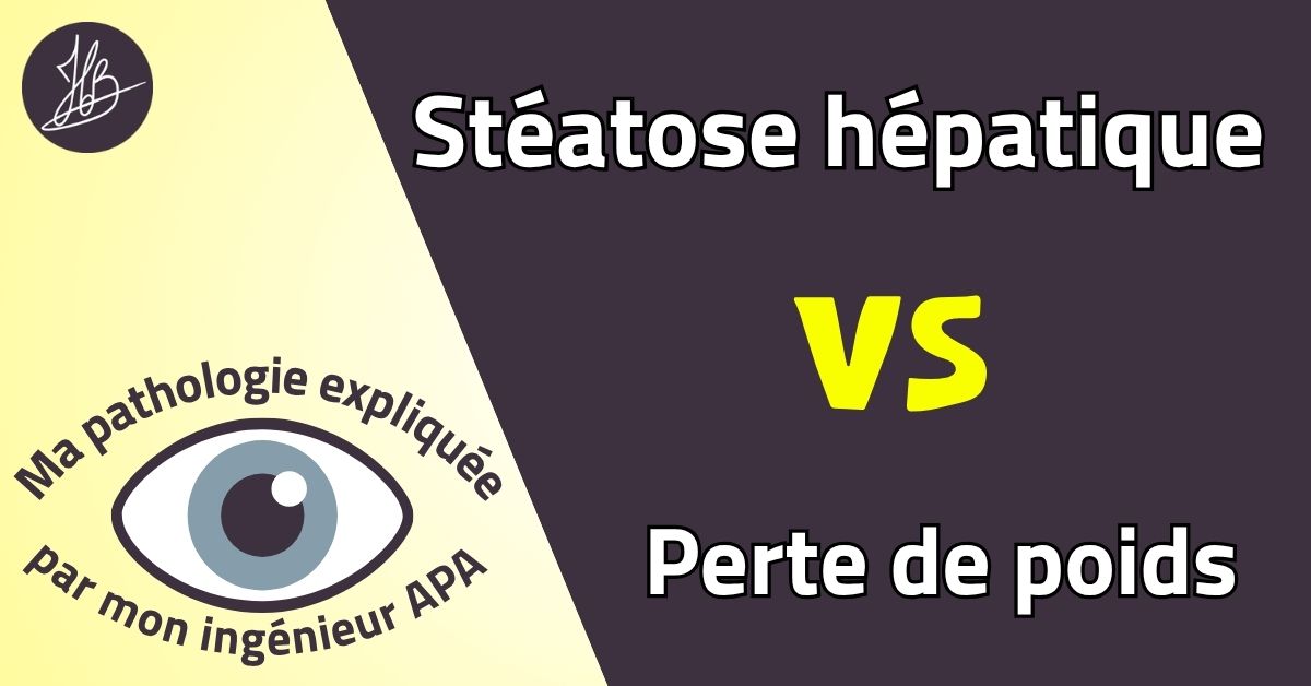 Stéatose hépatique VS Perte de poids – Ma pathologie expliquée