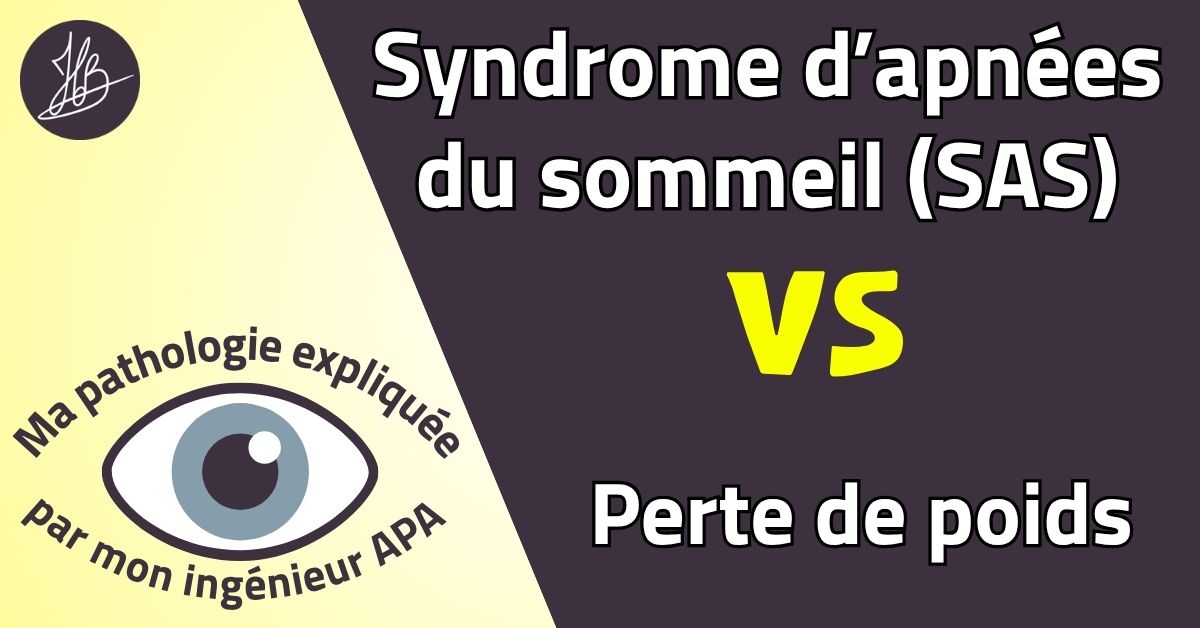 Syndrome d’apnées du sommeil (SAS) VS Perte de poids – Ma pathologie expliquée